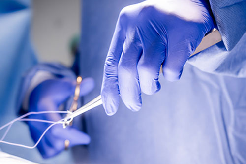 Chirurgie ambulatoire